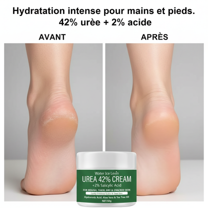 New 42% Urea Cream + 2% Salicylic acid Foot and hand Moisturizer, deep moisturizer and Nourishing moisturizer